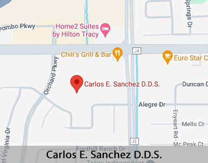 Map image for Dental Crowns and Dental Bridges in Tracy, CA